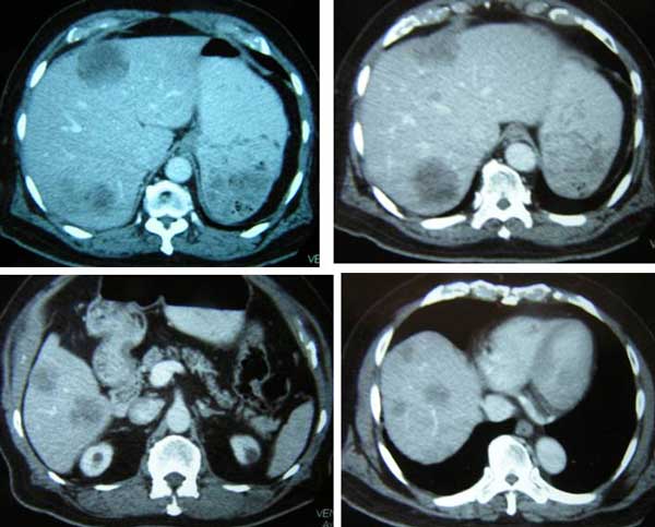 Composite-3-April-2012