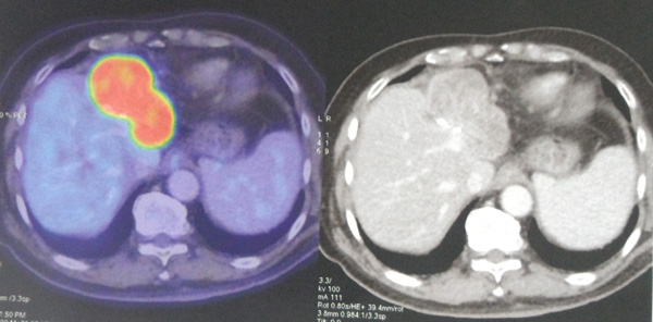 11-Mar-13-recurrence