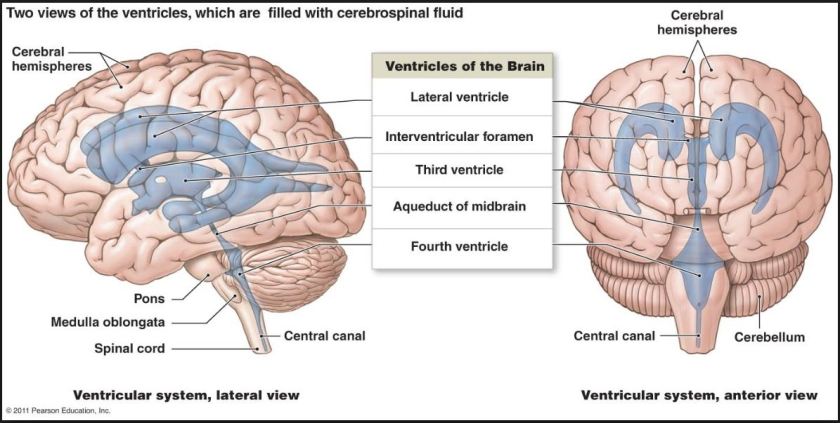 3rd-ventricle-2